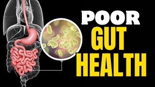 How to Improve Gut Health 5 foods to INSTANTLY improve GUT HEALTH [upl. by Coffeng332]