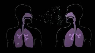 How Tuberculosis Begins [upl. by Kristal]