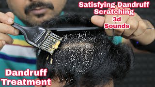 Satisfying Dandruff Scratching ASMR Dandruff Treatment by biswajit barber [upl. by Neffirg]