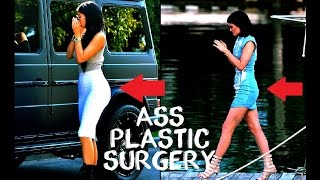 KYLIE JENNER  PLASTIC SURGERY INJECTION [upl. by Aurie420]