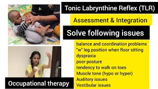 Tonic labyrinthine reflex TLR How to test amp integrate TLR primitive reflexoccupational therapy [upl. by Ribaj]