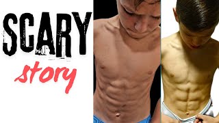 What Happened to My Abs  10 Pack or injury [upl. by Welsh]