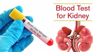 Renal Function Test  RFTs  Blood🔴 Test for Kidneys Medicalinformations994rftsantana bloodtest [upl. by Ewen]