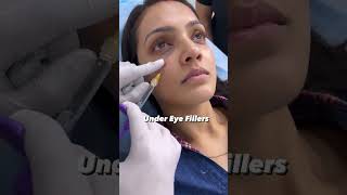 under eye filler treatment helps you get rid of wrinkles  Dermalyn Aesthetics  Dr Muskan Tyagi [upl. by Yffub]