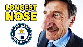 Life with the longest nose  Guinness World Records [upl. by Brechtel]