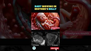 Baby movement 💕 Fetal movement  Baby moving inside mothers womb shortsfeed baby pregnancy [upl. by Birecree263]