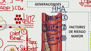 Cardiología  Cardiopatia isquemica cronica angina estable coronografia [upl. by Aimak]