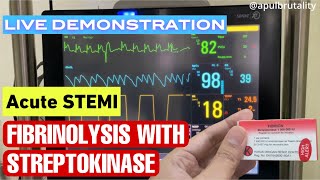 Fibrinolysis with streptokinase in acute STEMI  fibrinolisis pada STEMI serangan jantung berat [upl. by Mars]