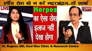 Herpes हर्पीस रोग का ऐसा ठोस इलाज नहीं देखा होगा  Dr Raghav  Heal Max Clinic  National khabar [upl. by Oehsen]