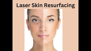 Laser skin resurfacing skincaretreatment collagenboost [upl. by Onivag]