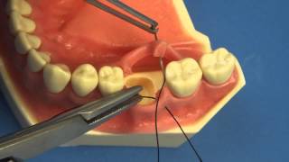 LEARN TO SUTURE THE EASY WAY  Surgical Technique  Interrupted Buccal Suturing  Dental  Medical [upl. by Arutak]