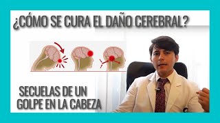 Recuperación después de un golpe en la cabeza Rehabilitación del traumatismo craneoencefálico [upl. by Rizas]