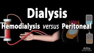 Renal Replacement Therapy Hemodialysis vs Peritoneal Dialysis Animation [upl. by Nsaj]