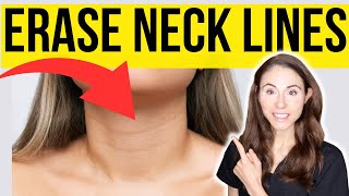 5 Tips To Erase Neck Lines [upl. by Anatnas135]