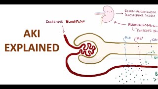 Acute Kidney Injury Explained [upl. by Chevalier]