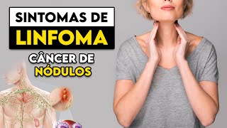 TOME CUIDADO Estes são os sinais e sintomas do LINFOMA │ Médico Explica [upl. by Secnarf581]