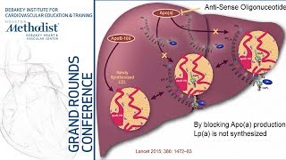 Lipoproteina in Coronary Disease An Emerging Novel Target Steven E Nissen MD February 14 2019 [upl. by Novick906]