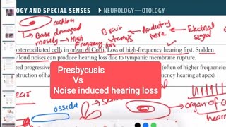 presbycusis Vs noise induced hearing loss otorhinolaryngology 4  First Aid USMLE Step 1 in Urdu [upl. by Neu754]