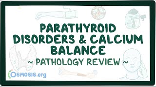 Parathyroid disorders and calcium balance Pathology Review [upl. by Ponton]