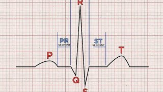 Ekg Dalgaları  Ekg Okuma🩺 [upl. by Hairom569]