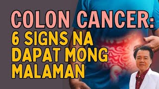 Sa Colon Cancer 6 Signs na Dapat Mong Malaman Repost Video [upl. by Zelikow]