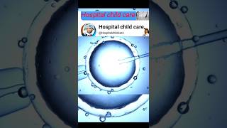 IVF procedure shorts ytshorts ivf procédure viralvideo hospitalchildcare [upl. by Bendicty673]