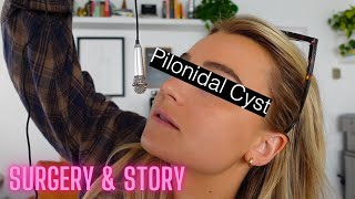 MY PILONODAL CYST Story amp Surgery 😱 ✨ [upl. by Ahsuatal]