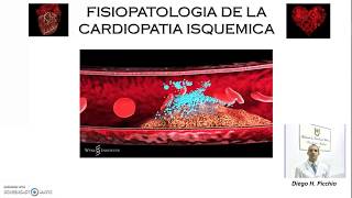 Fisiopatologia De la Cardiopatia Isquemica [upl. by Marna949]