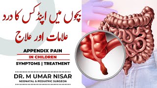 Appendix in Children  Appendix Pain Symptoms and Surgery UrduHindi [upl. by Agate896]