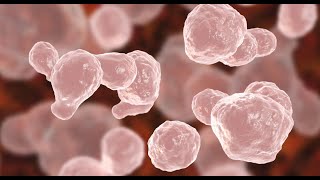 Cryptococcus Neoformans Infection [upl. by Gredel]