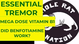 Essential Tremor cure using mega dose vitamin B1 Thiamine using Benfotiamine 3 mon Trial results [upl. by Innis]