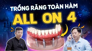 Trồng Răng Implant AllOn4 06 Lý Do Vẫn Giữ Ngôi quotĐầu Bảngquot Trong Điều Trị Mất Răng Toàn Hàm [upl. by Letitia]