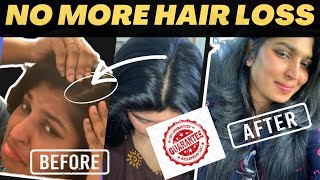 How To Avoid Hair Loss amp Improve Hair Growth  Tamil Weight Loss amp Hair Loss  Sakiye Sathya [upl. by Rufena]