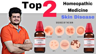 Top 2 Homeopathic Medicine for Skin  चर्म रोग की सबसे बेहतरीन दो होम्योपैथिक दवा [upl. by Xever818]