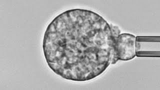 Human neutrophil versus Coccidioides cause of Valley fever Chemotaxis adhesion and phagocytosis [upl. by Alaecim]