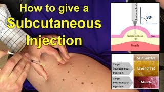 How to Give a Subcutaneous Injection Video [upl. by Ellirpa]