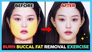 ✨ BURN BUCCAL FAT REMOVAL EXERCISE amp MASSAGE  Cheek fat loss Cheek lift Face fat loss [upl. by Nosredna240]