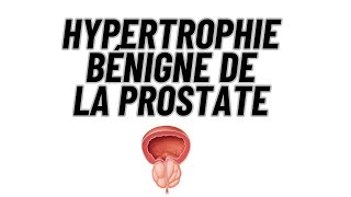 Hypertrophie bénigne de la prostate [upl. by Ahsiral]