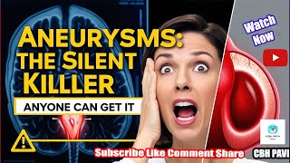 Aneurysm Symptoms Signs You Shouldnt Overlook [upl. by Warthman256]