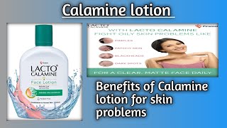 CALAMINE LOTION USES IN HINDI [upl. by Salazar]