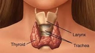 Goiter at Thyroid Kailan Dapat Operahan  ni Doc Ramon Estrada 6 [upl. by Mazlack700]