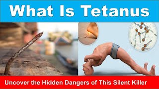 Tetanus Rusty Nails and Locked Jaws The History and Science of Tetanus Explained [upl. by Atteuqahs547]