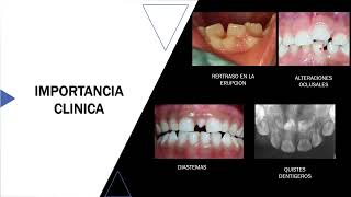 ANOMALIAS DENTARIAS [upl. by Assiran]