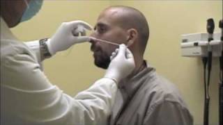 Procedure for Nasopharyngeal Swabs and Aspirates [upl. by Ybbob]