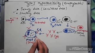 Type 1 hypersensitivity hindi [upl. by Roseanna]