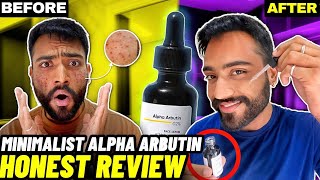 Best Serum For Dark Spots Minimalist ALPHA ARBUTIN Serum Review How to use Results Benefits [upl. by Sloan]