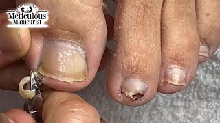 Mr Meticulous Deep Sidewall Cleaning Ingrown Prevention [upl. by Trudey595]