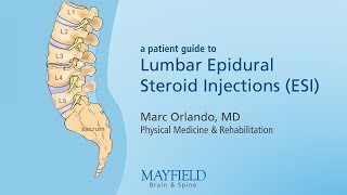 Lumbar Epidural Steroid Injections [upl. by Stoddart]