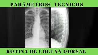 Rotina de coluna dorsal Saiba como realizar um exame padrão ANATOMIA RADIOLÓGICA [upl. by Esra]