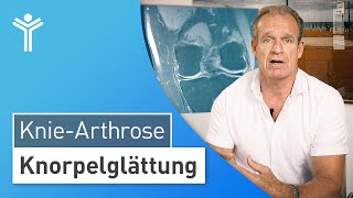 Knorpelschaden am Knie Wann macht die Knorpelglättung Sinn [upl. by Davis95]